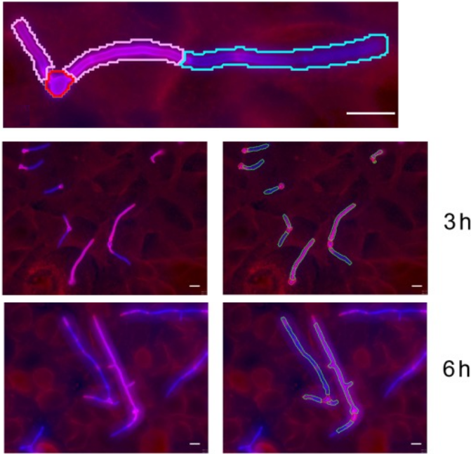 projects-models-for-candida-albicans-invasion-and-hyphal-growth-figure1.png
